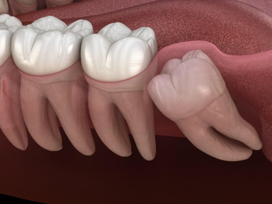 ORAL AND MAXILLOFACIAL SURGERIES IN SURAT